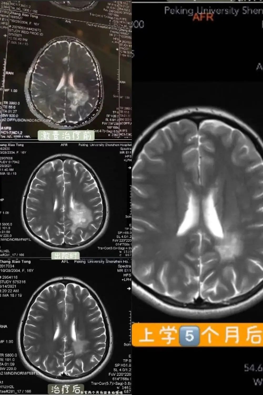 这届年轻人的身体到底能有多差？插图3